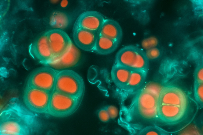 <em>Chroococcus</em> es un género de cianobacteria que puede crecer sobre las rocas. Organismos más cercanos a las bacterias que a las algas, han sido por siglos, responsables de la producción de oxígeno a través de la fotosíntesis.