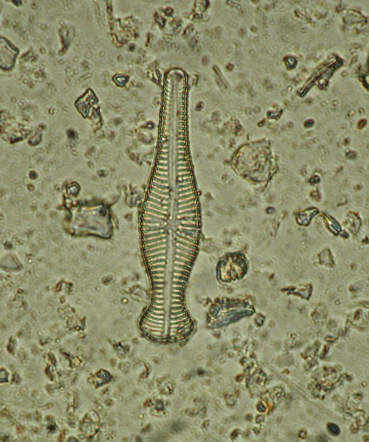 Diatomea Diatomea